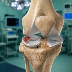 Meniscus Repair & Ligament Reconstruction icon