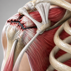 Rotator Cuff Repair & Instability Management icon